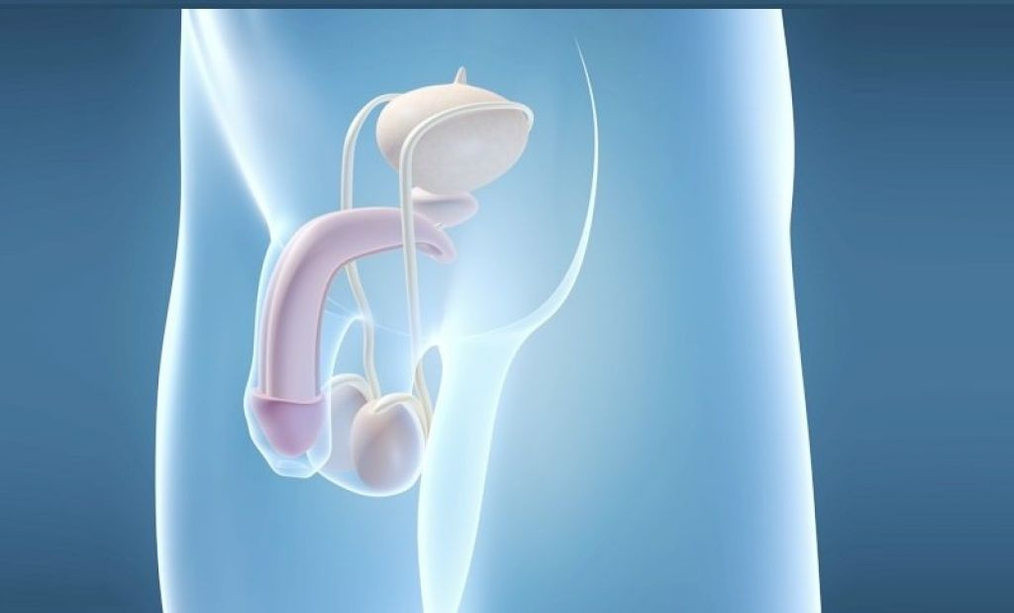 Імплантація протезу – хірургічний метод збільшення статевого члена чоловіка